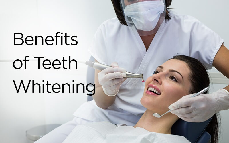 8 Top Benefits of Teeth Whitening