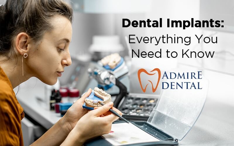 Everything You Need To Know dental implants