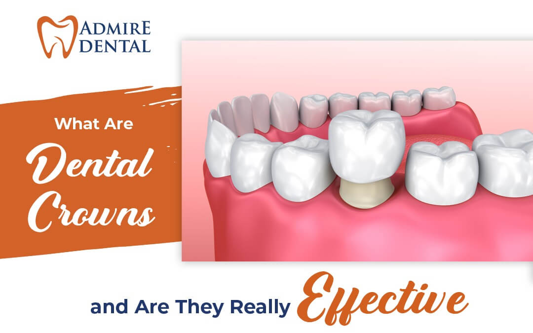 What Are Dental Crowns and Are They Really Effective?